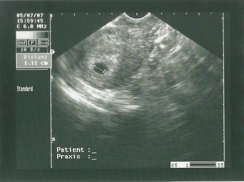 Schwangerschaftskalender ab der ersten Woche bei der Erdbeerlounge